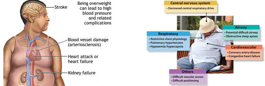 cylinder Oxygen for ohs